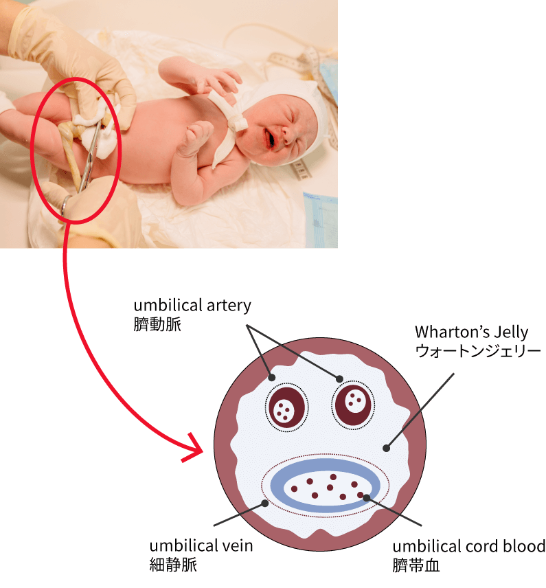 臍帯からウォートンジェリーを採取する図解